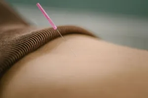 Needle inserted in lower abdomen